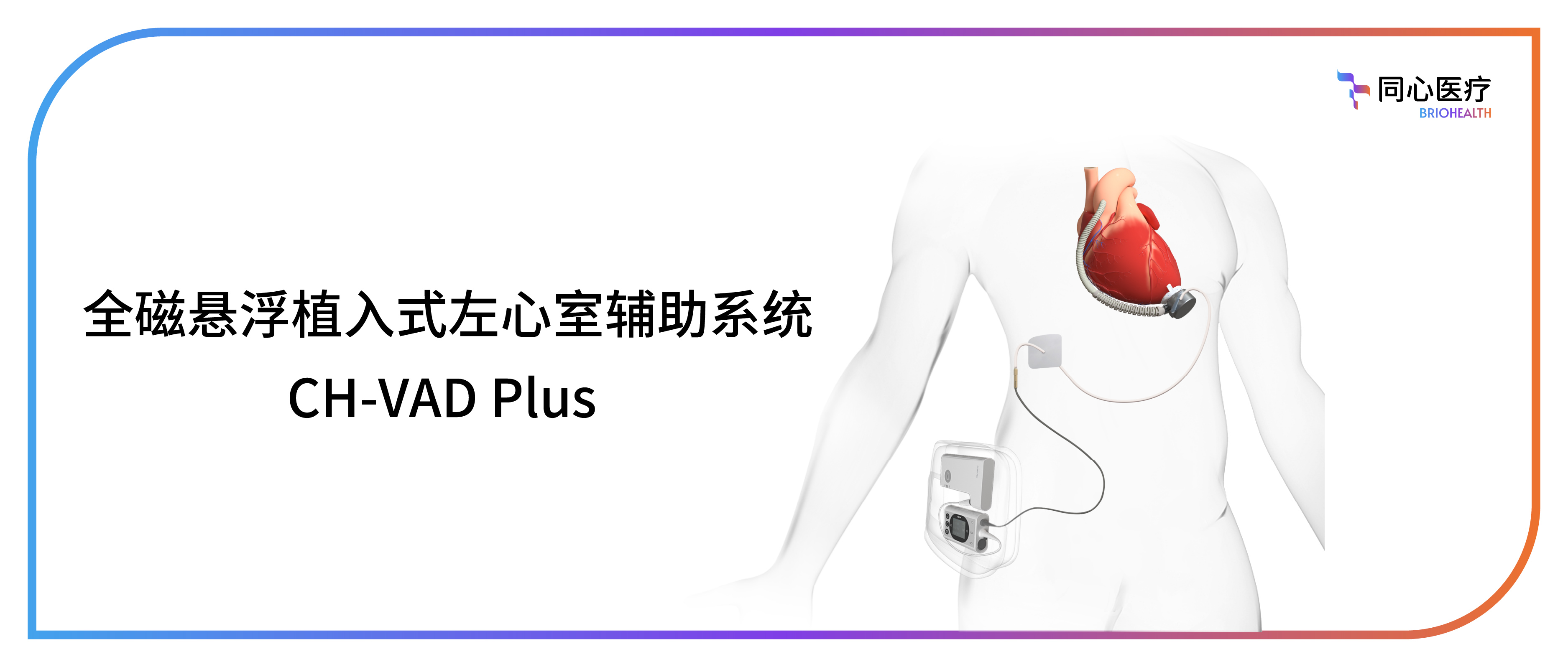 祝賀！同心醫(yī)療新一代人工心臟CH-VAD Plus正式上市，以臨床需求持續(xù)驅(qū)動(dòng)技術(shù)創(chuàng)新
